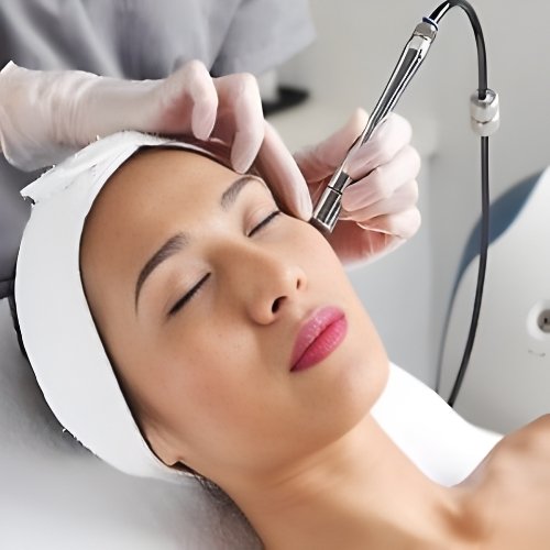 Microdermabrasion Facial
